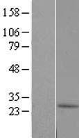 C10orf67 Protein - Western validation with an anti-DDK antibody * L: Control HEK293 lysate R: Over-expression lysate
