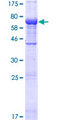 C10orf88 Protein - 12.5% SDS-PAGE of human C10orf88 stained with Coomassie Blue