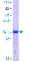 C11 / POLR3K Protein - 12.5% SDS-PAGE of human POLR3K stained with Coomassie Blue