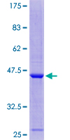 C11orf1 Protein - 12.5% SDS-PAGE of human C11orf1 stained with Coomassie Blue