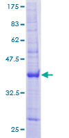 C11orf15 / TMEM9B Protein - 12.5% SDS-PAGE of human C11orf15 stained with Coomassie Blue