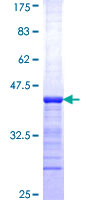 C11orf30 / EMSY Protein - 12.5% SDS-PAGE Stained with Coomassie Blue.