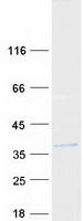 C11orf46 Protein - Purified recombinant protein ARL14EP was analyzed by SDS-PAGE gel and Coomassie Blue Staining