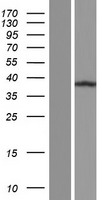 C11orf49 Protein - Western validation with an anti-DDK antibody * L: Control HEK293 lysate R: Over-expression lysate