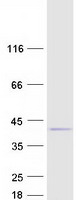 C11orf49 Protein - Purified recombinant protein C11orf49 was analyzed by SDS-PAGE gel and Coomassie Blue Staining