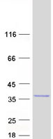 C11orf53 Protein - Purified recombinant protein C11orf53 was analyzed by SDS-PAGE gel and Coomassie Blue Staining