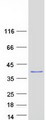 C11orf58 Protein - Purified recombinant protein C11orf58 was analyzed by SDS-PAGE gel and Coomassie Blue Staining