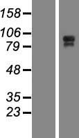 C11orf63 Protein - Western validation with an anti-DDK antibody * L: Control HEK293 lysate R: Over-expression lysate