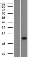 C11orf71 Protein - Western validation with an anti-DDK antibody * L: Control HEK293 lysate R: Over-expression lysate