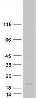 C11orf86 Protein - Purified recombinant protein C11orf86 was analyzed by SDS-PAGE gel and Coomassie Blue Staining