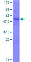 C11orf87 Protein - 12.5% SDS-PAGE of human C11orf87 stained with Coomassie Blue