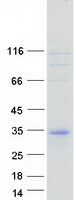 C11orf87 Protein - Purified recombinant protein C11orf87 was analyzed by SDS-PAGE gel and Coomassie Blue Staining