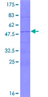 C11orf88 Protein - 12.5% SDS-PAGE of human FLJ46266 stained with Coomassie Blue