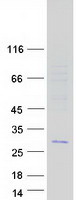C11orf88 Protein - Purified recombinant protein C11orf88 was analyzed by SDS-PAGE gel and Coomassie Blue Staining