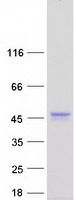 C12orf10 Protein - Purified recombinant protein C12orf10 was analyzed by SDS-PAGE gel and Coomassie Blue Staining