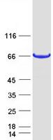 C12orf26 Protein - Purified recombinant protein METTL25 was analyzed by SDS-PAGE gel and Coomassie Blue Staining