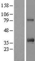 C12orf43 Protein - Western validation with an anti-DDK antibody * L: Control HEK293 lysate R: Over-expression lysate
