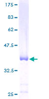 C12orf57 Protein - 12.5% SDS-PAGE of human GRCC10 stained with Coomassie Blue