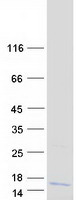 C12orf73 Protein - Purified recombinant protein C12orf73 was analyzed by SDS-PAGE gel and Coomassie Blue Staining