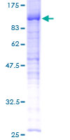 C13orf34 / BORA Protein - 12.5% SDS-PAGE of human FLJ22624 stained with Coomassie Blue