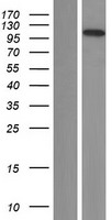 C14orf131 / ZNF839 Protein - Western validation with an anti-DDK antibody * L: Control HEK293 lysate R: Over-expression lysate