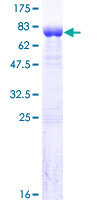 C14orf131 / ZNF839 Protein - 12.5% SDS-PAGE of human C14orf131 stained with Coomassie Blue