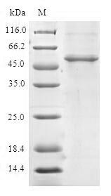 C14orf166 Protein - (Tris-Glycine gel) Discontinuous SDS-PAGE (reduced) with 5% enrichment gel and 15% separation gel.
