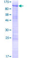 C14orf169 / NO66 Protein - 12.5% SDS-PAGE of human C14orf169 stained with Coomassie Blue