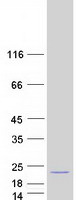 C14orf181 Protein - Purified recombinant protein C14orf181 was analyzed by SDS-PAGE gel and Coomassie Blue Staining