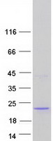 C14orf184 Protein - Purified recombinant protein C14orf184 was analyzed by SDS-PAGE gel and Coomassie Blue Staining