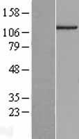 C14orf43 Protein - Western validation with an anti-DDK antibody * L: Control HEK293 lysate R: Over-expression lysate
