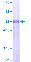 C15orf29 Protein - 12.5% SDS-PAGE of human C15orf29 stained with Coomassie Blue