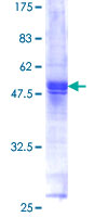 C16orf5 / I1 Protein - 12.5% SDS-PAGE of human C16orf5 stained with Coomassie Blue