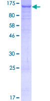 C16orf62 Protein - 12.5% SDS-PAGE of human C16orf62 stained with Coomassie Blue
