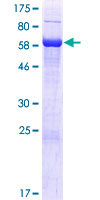 C16orf70 / LIN10 Protein - 12.5% SDS-PAGE of human C16orf70 stained with Coomassie Blue