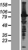 C16orf71 Protein - Western validation with an anti-DDK antibody * L: Control HEK293 lysate R: Over-expression lysate