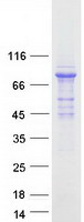 C16orf71 Protein - Purified recombinant protein C16orf71 was analyzed by SDS-PAGE gel and Coomassie Blue Staining