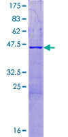 C16orf87 Protein - 12.5% SDS-PAGE of human LOC388272 stained with Coomassie Blue