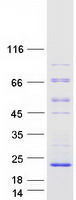 C16orf95 Protein - Purified recombinant protein C16orf95 was analyzed by SDS-PAGE gel and Coomassie Blue Staining