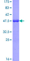 C17orf49 Protein - 12.5% SDS-PAGE of human C17orf49 stained with Coomassie Blue
