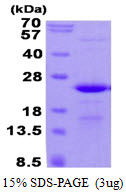 C17orf49 Protein