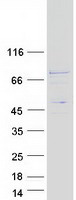 C17orf53 Protein - Purified recombinant protein C17orf53 was analyzed by SDS-PAGE gel and Coomassie Blue Staining