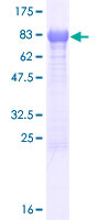C17orf57 Protein - 12.5% SDS-PAGE of human C17orf57 stained with Coomassie Blue
