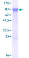 C17orf57 Protein - 12.5% SDS-PAGE of human C17orf57 stained with Coomassie Blue