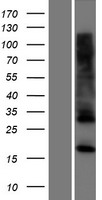 C17orf62 Protein - Western validation with an anti-DDK antibody * L: Control HEK293 lysate R: Over-expression lysate