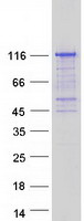 C17orf71 Protein - Purified recombinant protein SMG8 was analyzed by SDS-PAGE gel and Coomassie Blue Staining