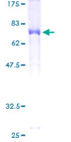 C17orf75 Protein - 12.5% SDS-PAGE of human NJMU-R1 stained with Coomassie Blue