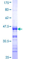 C17orf75 Protein - 12.5% SDS-PAGE Stained with Coomassie Blue.