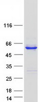C17orf75 Protein - Purified recombinant protein C17orf75 was analyzed by SDS-PAGE gel and Coomassie Blue Staining