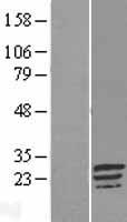 C17orf82 Protein - Western validation with an anti-DDK antibody * L: Control HEK293 lysate R: Over-expression lysate